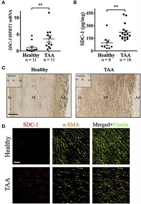 Syndecan-1 Is Overexpressed in Human Thoracic Aneurysm but Is Dispensable for the Disease Progression in a Mouse Model